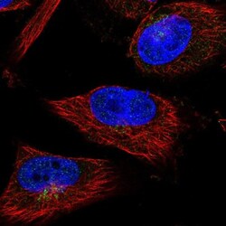 SHFM3 Antibody, Novus Biologicals 0.1mL; Unlabeled:Antibodies, Polyclonal